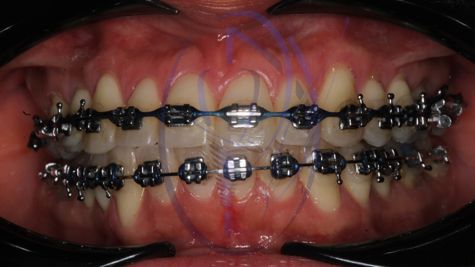 Procedimiento en curso